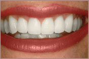 smiledesign-a.jpg