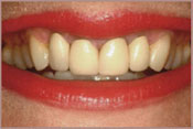 smiledesign-b.jpg